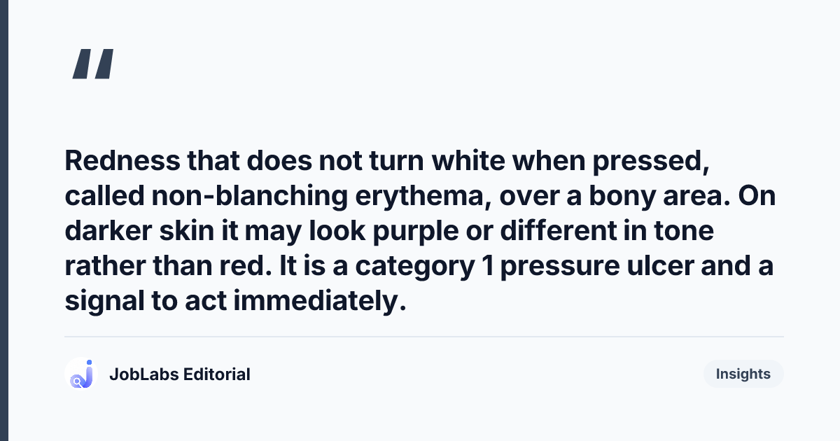 Key takeaway from Pressure Ulcer Risk (Waterlow/Braden) Questions